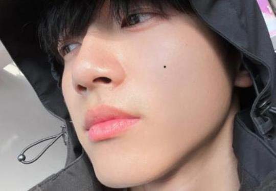 男性脸颊长痣代表什么