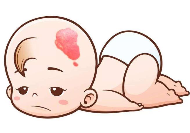 红胎记代表什么？